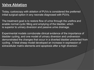 Valve Ablation
Today, cystoscopy with ablation of PUVs is considered the preferred
initial surgical option in any neonate diagnosed with PUVs.
The treatment goal is to restore flow of urine through the urethra and
enable normal cyclic filling and emptying of the bladder, which
is superior to urinary diversion and passive urine drainage.
Experimental models corroborate clinical evidence of the importance of
bladder cycling, and one model of urinary diversion and undiversion
demonstrated the changes that occur in a diverted bladder prevented from
cycling . A fetal sheep model developed an increase in expression of
extracellular matrix elements and apoptosis after a high diversion .
 