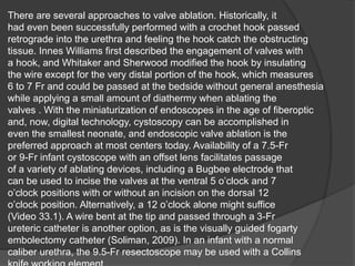 There are several approaches to valve ablation. Historically, it
had even been successfully performed with a crochet hook passed
retrograde into the urethra and feeling the hook catch the obstructing
tissue. Innes Williams first described the engagement of valves with
a hook, and Whitaker and Sherwood modified the hook by insulating
the wire except for the very distal portion of the hook, which measures
6 to 7 Fr and could be passed at the bedside without general anesthesia
while applying a small amount of diathermy when ablating the
valves . With the miniaturization of endoscopes in the age of fiberoptic
and, now, digital technology, cystoscopy can be accomplished in
even the smallest neonate, and endoscopic valve ablation is the
preferred approach at most centers today. Availability of a 7.5-Fr
or 9-Fr infant cystoscope with an offset lens facilitates passage
of a variety of ablating devices, including a Bugbee electrode that
can be used to incise the valves at the ventral 5 o’clock and 7
o’clock positions with or without an incision on the dorsal 12
o’clock position. Alternatively, a 12 o’clock alone might suffice
(Video 33.1). A wire bent at the tip and passed through a 3-Fr
ureteric catheter is another option, as is the visually guided fogarty
embolectomy catheter (Soliman, 2009). In an infant with a normal
caliber urethra, the 9.5-Fr resectoscope may be used with a Collins
 