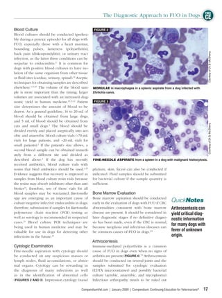 FREE
                                                             The Diagnostic Approach to FUO in Dogs CE

Blood Culture                                          FIGURE 2
Blood cultures should be conducted (prefera-
bly during a pyrexic episode) for all dogs with
FUO, especially those with a heart murmur,
bounding pulses, lameness (polyarthritis),




                                                                                                                                            Courtesy of Dr.Ty McSherry
back pain (diskospondylitis), or urinary tract
infection, as the latter three conditions can be
sequelae to endocarditis.17 It is common for
dogs with positive blood cultures to have iso-
lation of the same organism from other tissue
or ﬂuid sites (cardiac, urinary, spinal).18 Aseptic
techniques for obtaining samples are described
elsewhere.2,19,20 The volume of the blood sam-        MORULAE in macrophages in a splenic aspirate from a dog infected with
ple is more important than the timing; larger         Ehrlichia canis.
volumes are associated with an increased diag-
nostic yield in human medicine.19,21,22 Patient        FIGURE 3
size determines the amount of blood to be
drawn. As a general guideline, 16 to 20 mL of
blood should be obtained from large dogs,
and 5 mL of blood should be obtained from




                                                                                                                                            Courtesy of Dr.Ty McSherry
cats and small dogs.2 The blood should be
divided evenly and placed aseptically into aer-
obic and anaerobic blood culture vials (~70-mL
vials for large patients, and ~20-mL vials for
small patients).2 If the patient’s size allows, a
second blood sample can be obtained immedi-
ately from a different site and divided as
described above.2 If the dog has recently             FINE-NEEDLE ASPIRATE from a spleen in a dog with malignant histiocytosis.
received antibiotics, blood culture vials with
resins that bind antibiotics should be used.2,19      planum, skin, feces) can also be conducted if
Evidence suggests that recovery is improved in        indicated. Fluid samples should be submitted
samples from blood culture resin vials because        for bacterial culture if the sample quantity is
the resins may absorb inhibitors other than anti-     sufﬁcient.
biotics23; therefore, use of these vials for all
blood samples may be warranted. Bartonella            Bone Marrow Evaluation
spp are emerging as an important cause of             Bone marrow aspiration should be conducted
culture-negative infective endocarditis in dogs;      early in the evaluation of dogs with FUO if CBC
                                                                                                               QuickNotes
therefore, submission of samples for Bartonella       abnormalities consistent with bone marrow                Arthrocentesis can
polymerase chain reaction (PCR) testing as            disease are present. It should be considered in          yield critical diag-
well as serology is recommended in suspected          later diagnostic stages if no deﬁnitive diagno-
                                                                                                               nostic information
cases.24 Blood culture PCR techniques are             sis has been made, even if the CBC is normal,
being used in human medicine and may be               because neoplasia and infectious diseases can
                                                                                                               for many dogs with
valuable for use in dogs for detecting other          be common causes of FUO in dogs.2,8                      fever of unknown
infections in the future.25                                                                                    origin.
                                                      Arthrocentesis
Cytologic Examination                                 Immune-mediated polyarthritis is a common
Fine-needle aspiration with cytology should           cause of FUO in dogs even when no signs of
be conducted on any suspicious masses or              arthritis are present (FIGURE 4).7,8 Arthrocentesis
lymph nodes, ﬂuid accumulations, or abnor-            should be conducted on several joints and the
mal organs. Cytology can be rewarding in              samples submitted for cytologic evaluation
the diagnosis of many infections as well              (EDTA microcontainer) and possibly bacterial
as in the identiﬁcation of abnormal cells             culture (aerobic, anaerobic, and mycoplasma).
(FIGURES 2 AND 3). Impression cytology (nasal         Infectious arthropathy needs to be ruled out

                                              CompendiumVet.com | January 2009 | Compendium: Continuing Education for Veterinarians®   17
 
