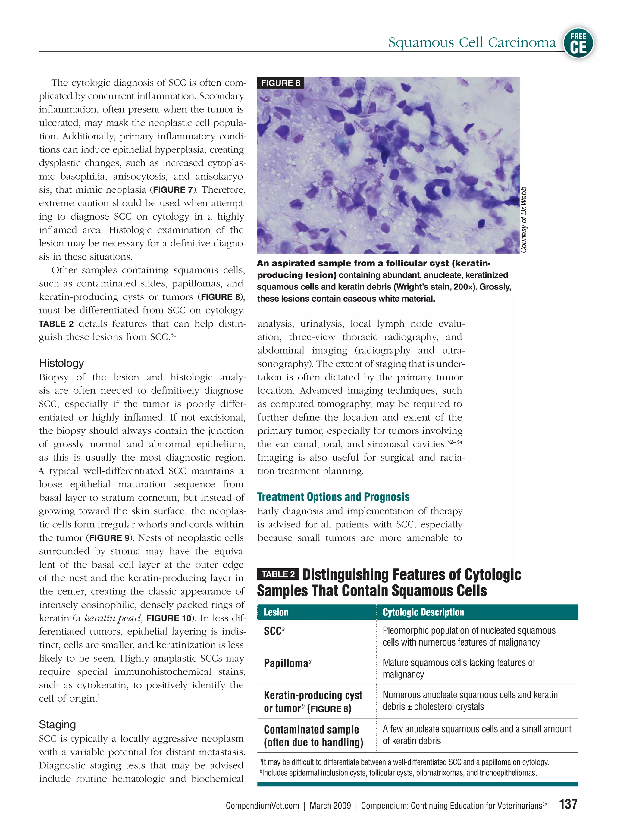 FREE
                                                                                                      Squamous Cell Carcinoma CE

    The cytologic diagnosis of SCC is often com-        FIGURE 8
plicated by concurrent inﬂammation. Secondary
inﬂammation, often present when the tumor is
ulcerated, may mask the neoplastic cell popula-
tion. Additionally, primary inﬂammatory condi-
tions can induce epithelial hyperplasia, creating
dysplastic changes, such as increased cytoplas-
mic basophilia, anisocytosis, and anisokaryo-
sis, that mimic neoplasia (FIGURE 7). Therefore,




                                                                                                                                                   Courtesy of Dr. Webb
extreme caution should be used when attempt-
ing to diagnose SCC on cytology in a highly
inﬂamed area. Histologic examination of the
lesion may be necessary for a deﬁnitive diagno-
sis in these situations.
                                                       An aspirated sample from a follicular cyst (keratin-
    Other samples containing squamous cells,           producing lesion) containing abundant, anucleate, keratinized
such as contaminated slides, papillomas, and           squamous cells and keratin debris (Wright’s stain, 200×). Grossly,
keratin-producing cysts or tumors (FIGURE 8),          these lesions contain caseous white material.
must be differentiated from SCC on cytology.
TABLE 2 details features that can help distin-         analysis, urinalysis, local lymph node evalu-
guish these lesions from SCC.31                        ation, three-view thoracic radiography, and
                                                       abdominal imaging (radiography and ultra-
Histology                                              sonography). The extent of staging that is under-
Biopsy of the lesion and histologic analy-             taken is often dictated by the primary tumor
sis are often needed to deﬁnitively diagnose           location. Advanced imaging techniques, such
SCC, especially if the tumor is poorly differ-         as computed tomography, may be required to
entiated or highly inﬂamed. If not excisional,         further deﬁne the location and extent of the
the biopsy should always contain the junction          primary tumor, especially for tumors involving
of grossly normal and abnormal epithelium,             the ear canal, oral, and sinonasal cavities.32–34
as this is usually the most diagnostic region.         Imaging is also useful for surgical and radia-
A typical well-differentiated SCC maintains a          tion treatment planning.
loose epithelial maturation sequence from
basal layer to stratum corneum, but instead of         Treatment Options and Prognosis
growing toward the skin surface, the neoplas-          Early diagnosis and implementation of therapy
tic cells form irregular whorls and cords within       is advised for all patients with SCC, especially
the tumor (FIGURE 9). Nests of neoplastic cells        because small tumors are more amenable to
surrounded by stroma may have the equiva-
lent of the basal cell layer at the outer edge
of the nest and the keratin-producing layer in               Distinguishing Features of Cytologic
                                                        TABLE 2

the center, creating the classic appearance of         Samples That Contain Squamous Cells
intensely eosinophilic, densely packed rings of
                                                           Lesion                                   Cytologic Description
keratin (a keratin pearl, FIGURE 10). In less dif-
ferentiated tumors, epithelial layering is indis-          SCCa                                     Pleomorphic population of nucleated squamous
tinct, cells are smaller, and keratinization is less                                                cells with numerous features of malignancy
likely to be seen. Highly anaplastic SCCs may                                                       Mature squamous cells lacking features of
                                                           Papillomaa
require special immunohistochemical stains,                                                         malignancy
such as cytokeratin, to positively identify the
cell of origin.1                                           Keratin-producing cyst                   Numerous anucleate squamous cells and keratin
                                                           or tumorb (FIGURE 8)                     debris ± cholesterol crystals
Staging                                                    Contaminated sample                      A few anucleate squamous cells and a small amount
SCC is typically a locally aggressive neoplasm             (often due to handling)                  of keratin debris
with a variable potential for distant metastasis.
                                                       a
Diagnostic staging tests that may be advised               It may be difﬁcult to differentiate between a well-differentiated SCC and a papilloma on cytology.
                                                       b
                                                           Includes epidermal inclusion cysts, follicular cysts, pilomatrixomas, and trichoepitheliomas.
include routine hematologic and biochemical

                                              CompendiumVet.com | March 2009 | Compendium: Continuing Education for Veterinarians®                                        137
 