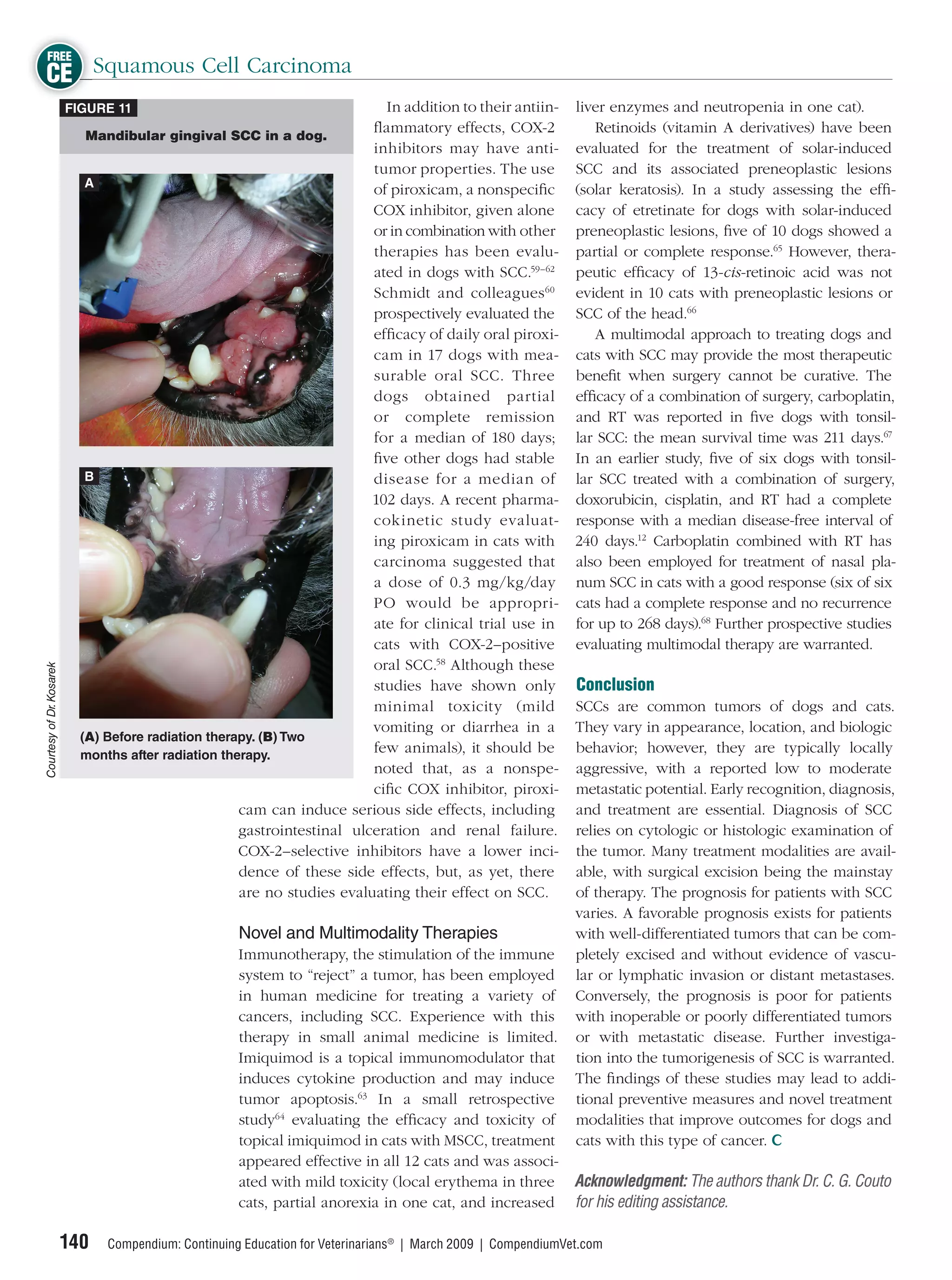 FREE
CE Squamous Cell Carcinoma
                          FIGURE 11                                         In addition to their antiin-       liver enzymes and neutropenia in one cat).
                             Mandibular gingival SCC in a dog.
                                                                          ﬂammatory effects, COX-2                Retinoids (vitamin A derivatives) have been
                                                                          inhibitors may have anti-            evaluated for the treatment of solar-induced
                                                                          tumor properties. The use            SCC and its associated preneoplastic lesions
                             A
                                                                          of piroxicam, a nonspeciﬁc           (solar keratosis). In a study assessing the efﬁ-
                                                                          COX inhibitor, given alone           cacy of etretinate for dogs with solar-induced
                                                                          or in combination with other         preneoplastic lesions, ﬁve of 10 dogs showed a
                                                                          therapies has been evalu-            partial or complete response.65 However, thera-
                                                                          ated in dogs with SCC.59–62          peutic efﬁcacy of 13-cis-retinoic acid was not
                                                                          Schmidt and colleagues 60            evident in 10 cats with preneoplastic lesions or
                                                                          prospectively evaluated the          SCC of the head.66
                                                                          efﬁcacy of daily oral piroxi-           A multimodal approach to treating dogs and
                                                                          cam in 17 dogs with mea-             cats with SCC may provide the most therapeutic
                                                                          surable oral SCC. Three              beneﬁt when surgery cannot be curative. The
                                                                          dogs obtained partial                efﬁcacy of a combination of surgery, carboplatin,
                                                                          or complete remission                and RT was reported in ﬁve dogs with tonsil-
                                                                          for a median of 180 days;            lar SCC: the mean survival time was 211 days.67
                                                                          ﬁve other dogs had stable            In an earlier study, ﬁve of six dogs with tonsil-
                             B                                            disease for a median of              lar SCC treated with a combination of surgery,
                                                                          102 days. A recent pharma-           doxorubicin, cisplatin, and RT had a complete
                                                                          cokinetic study evaluat-             response with a median disease-free interval of
                                                                          ing piroxicam in cats with           240 days.12 Carboplatin combined with RT has
                                                                          carcinoma suggested that             also been employed for treatment of nasal pla-
                                                                          a dose of 0.3 mg/kg/day              num SCC in cats with a good response (six of six
                                                                          PO would be appropri-                cats had a complete response and no recurrence
                                                                          ate for clinical trial use in        for up to 268 days).68 Further prospective studies
                                                                          cats with COX-2–positive             evaluating multimodal therapy are warranted.
                                                                          oral SCC.58 Although these
Courtesy of Dr. Kosarek




                                                                          studies have shown only              Conclusion
                                                                          minimal toxicity (mild               SCCs are common tumors of dogs and cats.
                                                                          vomiting or diarrhea in a            They vary in appearance, location, and biologic
                            (A) Before radiation therapy. (B) Two
                            months after radiation therapy.
                                                                          few animals), it should be           behavior; however, they are typically locally
                                                                          noted that, as a nonspe-             aggressive, with a reported low to moderate
                                                                          ciﬁc COX inhibitor, piroxi-          metastatic potential. Early recognition, diagnosis,
                                                      cam can induce serious side effects, including           and treatment are essential. Diagnosis of SCC
                                                      gastrointestinal ulceration and renal failure.           relies on cytologic or histologic examination of
                                                      COX-2–selective inhibitors have a lower inci-            the tumor. Many treatment modalities are avail-
                                                      dence of these side effects, but, as yet, there          able, with surgical excision being the mainstay
                                                      are no studies evaluating their effect on SCC.           of therapy. The prognosis for patients with SCC
                                                                                                               varies. A favorable prognosis exists for patients
                                                      Novel and Multimodality Therapies                        with well-differentiated tumors that can be com-
                                                      Immunotherapy, the stimulation of the immune             pletely excised and without evidence of vascu-
                                                      system to “reject” a tumor, has been employed            lar or lymphatic invasion or distant metastases.
                                                      in human medicine for treating a variety of              Conversely, the prognosis is poor for patients
                                                      cancers, including SCC. Experience with this             with inoperable or poorly differentiated tumors
                                                      therapy in small animal medicine is limited.             or with metastatic disease. Further investiga-
                                                      Imiquimod is a topical immunomodulator that              tion into the tumorigenesis of SCC is warranted.
                                                      induces cytokine production and may induce               The ﬁndings of these studies may lead to addi-
                                                      tumor apoptosis.63 In a small retrospective              tional preventive measures and novel treatment
                                                      study64 evaluating the efﬁcacy and toxicity of           modalities that improve outcomes for dogs and
                                                      topical imiquimod in cats with MSCC, treatment           cats with this type of cancer.
                                                      appeared effective in all 12 cats and was associ-
                                                      ated with mild toxicity (local erythema in three Acknowledgment: The authors thank Dr. C. G. Couto
                                                      cats, partial anorexia in one cat, and increased for his editing assistance.

                          140   Compendium: Continuing Education for Veterinarians® | March 2009 | CompendiumVet.com
 