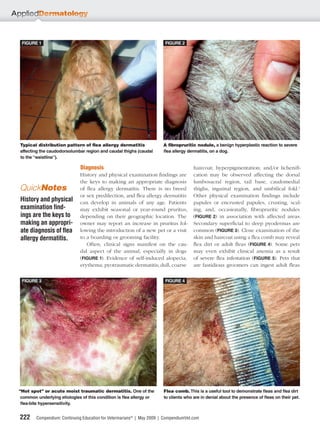 FIGURE 1                                                               FIGURE 2




Typical distribution pattern of ﬂea allergy dermatitis                  A ﬁbropruritic nodule, a benign hyperplastic reaction to severe
affecting the caudodorsolumbar region and caudal thighs (caudal         flea allergy dermatitis, on a dog.
to the “waistline”).

                              Diagnosis                                                haircoat; hyperpigmentation; and/or licheniﬁ-
                             History and physical examination ﬁndings are              cation may be observed affecting the dorsal
                             the keys to making an appropriate diagnosis               lumbosacral region, tail base, caudomedial
QuickNotes                   of ﬂea allergy dermatitis. There is no breed              thighs, inguinal region, and umbilical fold.1
                             or sex predilection, and ﬂea allergy dermatitis           Other physical examination ﬁndings include
History and physical         can develop in animals of any age. Patients               papules or encrusted papules, crusting, scal-
examination ﬁnd-             may exhibit seasonal or year-round pruritus,              ing, and, occasionally, ﬁbropruritic nodules
ings are the keys to         depending on their geographic location. The               (FIGURE 2) in association with affected areas.
making an appropri-          owner may report an increase in pruritus fol-             Secondary superﬁcial to deep pyodermas are
ate diagnosis of ﬂea         lowing the introduction of a new pet or a visit           common (FIGURE 3). Close examination of the
allergy dermatitis.          to a boarding or grooming facility.                       skin and haircoat using a ﬂea comb may reveal
                                Often, clinical signs manifest on the cau-             ﬂea dirt or adult ﬂeas (FIGURE 4). Some pets
                             dal aspect of the animal, especially in dogs              may even exhibit clinical anemia as a result
                             (FIGURE 1). Evidence of self-induced alopecia;            of severe ﬂea infestation (FIGURE 5). Pets that
                             erythema; pyotraumatic dermatitis; dull, coarse           are fastidious groomers can ingest adult ﬂeas

 FIGURE 3                                                               FIGURE 4




“Hot spot” or acute moist traumatic dermatitis. One of the              Flea comb. This is a useful tool to demonstrate fleas and flea dirt
 common underlying etiologies of this condition is flea allergy or      to clients who are in denial about the presence of fleas on their pet.
 flea-bite hypersensitivity.


222     Compendium: Continuing Education for Veterinarians® | May 2009 | CompendiumVet.com
 