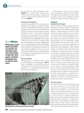 FREE
CE Pneumothorax
                             gus (normally not visible in healthy animals;                                      Thoracocentesis carries the risk of lacerat-
                             FIGURE 2). In animals that develop pneu-                                        ing or puncturing a lung lobe, which results
                             mothorax after thoracocentesis, rounded lung                                    in iatrogenic pneumothorax; however, proper
                             margins, consistent with chronic effusion, may                                  technique, caution, and recognition of at-risk
                             be seen (FIGURE 5).                                                             patients can minimize these complications.45

                             Computed Tomography                                                             Treatment
                             Computed tomography (CT) is routinely used                                      Supplemental Oxygen
                             in people for the diagnosis of bullae and blebs                                 Because atelectasis and ventilation/perfusion
                             because it is considered more sensitive than radi-                              mismatch can lead to hypoxia, animals with
                             ography.41 The accuracy of lesion identiﬁcation                                 pneumothorax may beneﬁt from supplemental
                             using CT in humans has been shown to range                                      oxygen.35 Oxygen therapy may also be beneﬁ-
                             from 88% to 91.8%.42–44 One study39 comparing                                   cial because these animals may have respira-
                             the accuracy of radiography and CT for bullae                                   tory and metabolic acidosis and hypercapnia.36
                             and bleb identiﬁcation in dogs with spontaneous                                 In animals with closed pneumothorax, oxy-
                             pneumothorax found radiography to be accurate                                   gen therapy can hasten the resolution of the
                             in 16% of cases and CT to be accurate in 80%                                    pneumothorax. The full physiology behind
 QuickNotes                  of cases. The authors of this study suggested that                              this mechanism is beyond the scope of this
                             CT was a better diagnostic tool than radiography                                article; however, it is based on differences in
 Radiographs readily
                             for the identiﬁcation of lung lesions associated                                partial pressures of blood gases. The extrapul-
 depict pneumotho-           with spontaneous pneumothorax.39 However, in                                    monary air of pneumothorax contains mainly
 rax; however, the           many veterinary patients, a CT scan is not per-                                 nitrogen and oxygen (~21%) and other minor
 underlying cause            formed preoperatively because the ﬁndings may                                   constituents. The partial pressure of oxygen
 may not be evident          not change the surgical approach and because                                    in the blood is approximately 100 mm Hg at
 on plain-ﬁlm radio-         of the additional costs.                                                        sea level and normal barometric pressure (760
 graphs. Computed                                                                                            mm Hg).46 When the oxygen content of the air
 tomography may             Thoracocentesis                                                                  delivered to an animal is higher than 21%, the
                            Thoracocentesis is beneﬁcial in that it may                                      partial pressure in the blood increases. This
 be useful in some
                            be both diagnostic and therapeutic (BOX 2).                                      causes a decrease in the partial pressure of
 cases.                     Often, radiography is conducted before thora-                                    other gases in the blood (e.g., nitrogen), which
                            cocentesis. However, thoracocentesis may be                                      in turn creates a pressure gradient for these
                            performed in a rapidly deteriorating patient                                     gases to diffuse from the pneumothorax into
                            without prior radiography.4,45                                                   the blood and eventually out of the system
                                                                                                             through respiration. Oxygen can be delivered
 FIGURE 4                                                                                                    by mask, nasal cannula, or cage/tank. It is
                                                                                                             important to minimize stress in these animals;
                                                                                                             therefore, for fractious or excited patients, an
                                                                                                             oxygen cage may be the best option.

                                                                                                             Thoracocentesis
                                                                                                             In animals with traumatic, closed pneumotho-
                                                                                                             rax, thoracocentesis can be curative, and
                                                                                                             recurrence is uncommon.4,37,45 Thoracocentesis
                                                                                                             should restore negative pressure within the
                                                                                                             thoracic cavity. If negative pressure cannot be
                                                                                                             reached, >10 mL/kg of air is aspirated within
                                                                                  Courtesy of Dr. Mauterer




                                                                                                             a 12-hour period, or repeated aspiration is
                                                                                                             required to alleviate respiratory distress, chest
                                                                                                             tube placement should be considered.2,8,47
                                                                                                             Open chest wounds should be covered imme-
                                                                                                             diately with a sterile, occlusive dressing to
                                                                                                             prevent further equilibration with atmospheric
 Radiograph of a pulmonary bulla (arrowhead).                                                                pressure and allow effective aspiration of air.

 236   Compendium: Continuing Education for Veterinarians® | May 2009 | CompendiumVet.com
 
