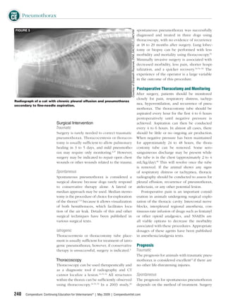 FREE
CE Pneumothorax
 FIGURE 5                                                                                                                                spontaneous pneumothorax was successfully




                                                                                  Courtesy of Elizabeth Rozanski, DVM, DACVECC, DACVIM
                                                                                                                                         diagnosed and treated in three dogs using
                                                                                                                                         thoracoscopy, with no evidence of recurrence
                                                                                                                                         at 18 to 29 months after surgery. Lung lobec-
                                                                                                                                         tomy or biopsy can be performed with less
                                                                                                                                         morbidity and mortality using thoracoscopy.52
                                                                                                                                         Minimally invasive surgery is associated with
                                                                                                                                         decreased morbidity, less pain, shorter hospi-
                                                                                                                                         talization, and a quicker recovery.34,54–56 The
                                                                                                                                         experience of the operator is a large variable
                                                                                                                                         in the outcome of this procedure.

                                                                                                                                         Postoperative Thoracotomy and Monitoring
                                                                                                                                         After surgery, patients should be monitored
                                                                                                                                         closely for pain, respiratory distress, tachyp-
 Radiograph of a cat with chronic pleural effusion and pneumothorax
 secondary to ﬁne-needle aspiration.
                                                                                                                                         nea, hypoventilation, and recurrence of pneu-
                                                                                                                                         mothorax. The thoracostomy tube should be
                                                                                                                                         aspirated every hour for the ﬁrst 4 to 6 hours
                                                                                                                                         postoperatively until negative pressure is
                            Surgical Intervention                                                                                        achieved. Aspiration can then be conducted
                            Traumatic                                                                                                    every 4 to 6 hours. In almost all cases, there
                            Surgery is rarely needed to correct traumatic                                                                should be little or no ongoing air production.
                            pneumothorax. Thoracocentesis or thoracos-                                                                   When negative pressure has been maintained
                            tomy is usually sufﬁcient to allow pulmonary                                                                 for approximately 24 to 48 hours, the thora-
                            healing in 3 to 5 days, and mild pneumotho-                                                                  costomy tube can be removed. Some sero-
                            rax may require only monitoring.3,37 However,                                                                sanguineous discharge may be present while
                            surgery may be indicated to repair open chest                                                                the tube is in the chest (approximately 2 to 4
                            wounds or other wounds related to the trauma.                                                                mL/kg/day).48 This will resolve once the tube
                                                                                                                                         is removed. If the animal shows any signs
                            Spontaneous                                                                                                  of respiratory distress or tachypnea, thoracic
                            Spontaneous pneumothorax is considered a                                                                     radiography should be conducted to assess for
                            surgical disease because dogs rarely respond                                                                 pleural effusion, recurrence of pneumothorax,
                            to conservative therapy alone. A lateral or                                                                  atelectasis, or any other potential lesion.
                            median approach may be used. Median sterno-                                                                     Postoperative pain is an important consid-
                            tomy is the procedure of choice for exploration                                                              eration in animals undergoing surgical explo-
                            of the thorax1,7,8 because it allows visualization                                                           ration of the thoracic cavity. Intercostal nerve
                            of both hemithoraces, which facilitates loca-                                                                blocks, interpleural regional anesthesia, con-
                            tion of the air leak. Details of this and other                                                              tinuous-rate infusion of drugs such as fentanyl
                            surgical techniques have been published in                                                                   or other opioid analgesics, and NSAIDs are
                            various surgical texts.                                                                                      all viable options to decrease the morbidity
                                                                                                                                         associated with these procedures. Appropriate
                            Iatrogenic                                                                                                   dosages of these agents have been published
                            Thoracocentesis or thoracostomy tube place-                                                                  in anesthesia/analgesia texts.
                            ment is usually sufﬁcient for treatment of iatro-
                            genic pneumothorax; however, if conservative Prognosis
                            therapy is unsuccessful, surgery is indicated.3 Traumatic
                                                                              The prognosis for animals with traumatic pneu-
                            Thoracoscopy                                      mothorax is considered excellent12 if there are
                            Thoracoscopy can be used therapeutically and no other life-threatening injuries.
                            as a diagnostic tool if radiography and CT
                            cannot localize a lesion.34,51,52 All structures Spontaneous
                            within the thorax can be sufﬁciently observed The prognosis for spontaneous pneumothorax
                            using thoracoscopy.34,51,53 In a 2003 study,40 depends on the method of treatment. Surgery

 240   Compendium: Continuing Education for Veterinarians® | May 2009 | CompendiumVet.com
 