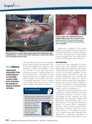 FIGURE 1                                                                               FIGURE 2




                                                                                      In many cases, the cryptorchid testis is
                                                                                      readily visible during initial visualization of the
                                                                                      peritoneal cavity. In this case, the testis can be
                                                                                      seen on the right side, lateral to the descending
                                                                                      colon and bladder.


                                                                                         Laparoscopic examination of the caudal
                                                                                      abdomen is a minimally invasive modality for
Port position for a totally laparoscopic approach for abdominal cryp-
                                                                                      conﬁrming the presence or absence of abdom-
torchidectomy in a dog. The subumbilical telescope port is placed first, followed     inal testes, and laparoscopic or laparoscopic-
by two paramedian instrument ports.                                                   assisted techniques have been described for
                                                                                      removal of abdominally cryptorchid testes.

                             collected before and 2 hours after administra- Instrumentation
                             tion of human chorionic gonadotropin (50 IU/ As well as the basic components of an endo-
QuickNotes                   kg IM) and submitted for testosterone assay. scopic tower,10 other equipment required to
                             Unilateral or bilateral monorchidism is very perform laparoscopic and laparoscopic-assisted
Laparoscopic                 rare; therefore, it is most likely that abdomi- cryptorchidectomy includes a laparoscope, two
examination of the           nal testes are present,7,9 making exploration of or three trocar–cannula assemblies, and lap-
caudal abdomen               the peritoneal cavity a reasonable next step. aroscopic surgical instruments. The most com-
is a minimally               Typically, exploration is accomplished via open monly used laparoscope size is 5 or 10 mm, and
                             surgery through a ventral midline celiotomy or the most common lens angles are 0° and 30°.
invasive modal-
                             a paramedian laparotomy.5 In cats, a standard Trocar–cannula assemblies can be disposable or
ity for conﬁrming            ventral midline laparotomy that must usually reusable and are usually 6 mm in diameter to
the presence or              extend caudally to the pubis is performed.       ﬁt 5-mm instrumentation. Typically, sterilizable,
absence of abdomi-                                                            reusable cannulas are more cost-effective than
nal testes.                                                                   single-use devices for veterinary use.
                                TO LEARN MORE                                    Instruments essential for laparoscopic cryp-
                                                                              torchidectomy include a blunt probe for tissue
                                                                              manipulation and Kelly or Babcock forceps
                                Basic laparoscopic equipment and the Hasson   for grasping the testis, spermatic cord, and
                                and Veress needle techniques are described in gubernaculum. For hemostasis during totally
                                the August 2008 article, “Canine Laparoscopic laparoscopic cryptorchidectomy, either a ves-
                                and Laparoscopic-Assisted                     sel-sealing device (e.g., Ligasure [Valleylab Inc.,
                                Ovariohysterectomy and
                                                                              Boulder, CO], Enseal [Ethicon Endosurgery,
                                Ovariectomy,” available at
                                                                              Cincinnati, OH], Harmonic Scalpel [Ethicon
                                CompendiumVet.com.
                                A video demonstrating
                                                                              Endosurgery, Cincinnati, OH]) can be used.
                                the Hasson technique                          If these devices are not available, hemostasis
                                is also available at                          can be achieved using either hemostatic clips
                                CompendiumVet.com.                            dispensed by a laparoscopic clip applier or
                                                                              extracorporeal suturing. A knot pusher is used

276    Compendium: Continuing Education for Veterinarians® | June 2009 | CompendiumVet.com
 