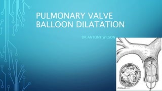 PULMONARY VALVE
BALLOON DILATATION
DR.ANTONY WILSON
 