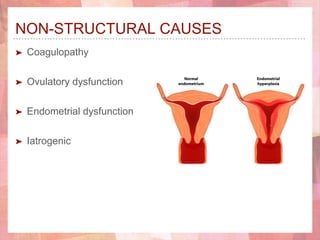 NON-STRUCTURAL CAUSES
➤ Coagulopathy
➤ Ovulatory dysfunction
➤ Endometrial dysfunction
➤ Iatrogenic
 