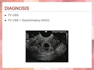 DIAGNOSIS
➤ TV USS
➤ TV USS + Discriminatory bHCG
 