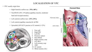 LOCALIZATION OF VPC
• PVC usually origin from
• Right Ventricle outflow tact (70%–80%)
• Non RVOT (10%–15%)(three papillary muscles, moderator
band and tricuspid annulus)
• Left ventricle outflow tract (15%–25%)
• Left ventricle papillary muscles(AL & PM)
• Epicardial (AIV/GCV junction or LV summit) (≈12%)
1. Free wall
2. Right PSC
3. Left PSC
4. Posterior septum
5. Para HISian
6. Right coronary cusp
7. LCC/RCC
8. Left coronary cusp
9. AMC
10. LV summit
11. Mitral annulus (AL)
 