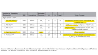 Anderson RD, Kumar S, Parameswaran R, et al. Differentiating Right- and Left-Sided Outflow Tract Ventricular Arrhythmias: Classical ECG Signatures and Prediction
Algorithms. Circ Arrhythm Electrophysiol. 2019;12(6):e007392. doi:10.1161/CIRCEP.119.007392
 