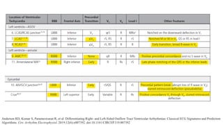 Anderson RD, Kumar S, Parameswaran R, et al. Differentiating Right- and Left-Sided Outflow Tract Ventricular Arrhythmias: Classical ECG Signatures and Prediction
Algorithms. Circ Arrhythm Electrophysiol. 2019;12(6):e007392. doi:10.1161/CIRCEP.119.007392
 