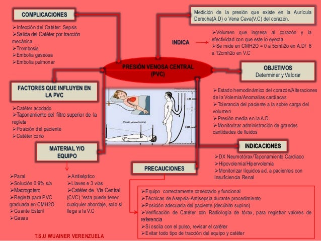 Presión Venosa Central (PVC)