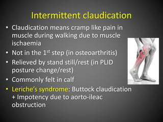 Intermittent claudication
• Claudication means cramp like pain in
muscle during walking due to muscle
ischaemia
• Not in the 1st step (in osteoarthritis)
• Relieved by stand still/rest (in PLID
posture change/rest)
• Commonly felt in calf
• Leriche’s syndrome: Buttock claudication
+ Impotency due to aorto-ileac
obstruction
 