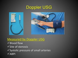 Doppler USG
Measured by Doppler USG
Blood flow
Site of stenosis
Systolic pressure of small arteries
ABPI
 