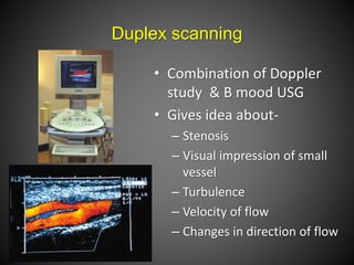Duplex scanning
• Combination of Doppler
study & B mood USG
• Gives idea about-
– Stenosis
– Visual impression of small
vessel
– Turbulence
– Velocity of flow
– Changes in direction of flow
 
