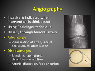 Angiography
• Invasive & indicated when
intervention is think about
• Using Sheldinger technique
• Usually through femoral artery
• Advantages
– Visualization of artery, site of
occlusion, collaterals seen
• Disadvantages
– Bleeding, haematoma,
thrombosis, embolism
– Arterial dissection, false aneurism
 
