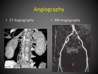 Angiography
• CT Angiography • MR Angiography
 