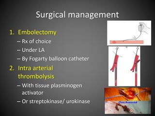 Surgical management
1. Embolectomy
– Rx of choice
– Under LA
– By Fogarty balloon catheter
2. Intra arterial
thrombolysis
– With tissue plasminogen
activator
– Or streptokinase/ urokinase
 
