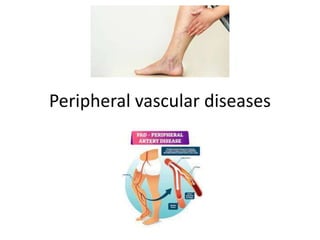 Peripheral vascular diseases
 