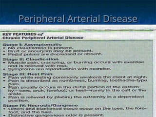 Peripheral Arterial Disease
Peripheral Arterial Disease
 