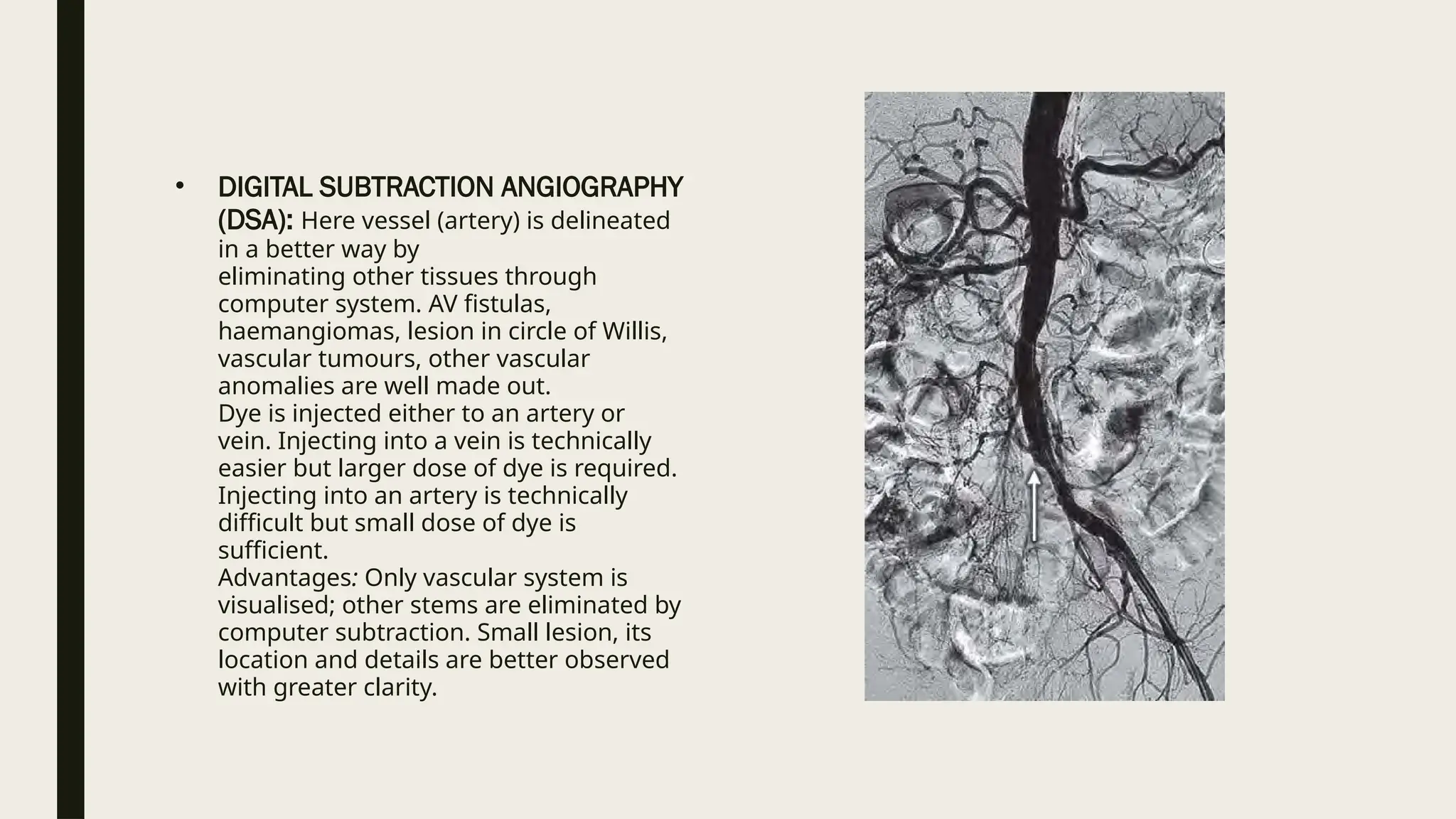 • DIGITAL SUBTRACTION ANGIOGRAPHY
(DSA): Here vessel (artery) is delineated
in a better way by
eliminating other tissues through
computer system. AV fistulas,
haemangiomas, lesion in circle of Willis,
vascular tumours, other vascular
anomalies are well made out.
Dye is injected either to an artery or
vein. Injecting into a vein is technically
easier but larger dose of dye is required.
Injecting into an artery is technically
difficult but small dose of dye is
sufficient.
Advantages: Only vascular system is
visualised; other stems are eliminated by
computer subtraction. Small lesion, its
location and details are better observed
with greater clarity.
 