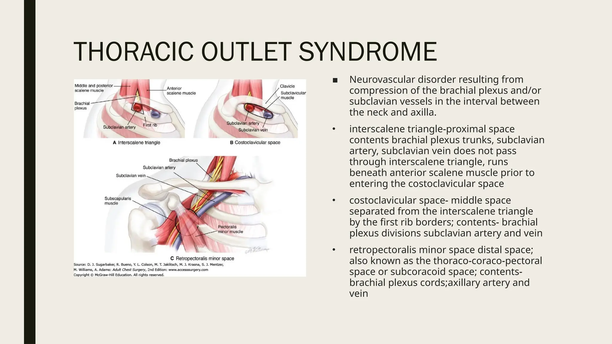 THORACIC OUTLET SYNDROME
■ Neurovascular disorder resulting from
compression of the brachial plexus and/or
subclavian vessels in the interval between
the neck and axilla.
• interscalene triangle-proximal space
contents brachial plexus trunks, subclavian
artery, subclavian vein does not pass
through interscalene triangle, runs
beneath anterior scalene muscle prior to
entering the costoclavicular space
• costoclavicular space- middle space
separated from the interscalene triangle
by the first rib borders; contents- brachial
plexus divisions subclavian artery and vein
• retropectoralis minor space distal space;
also known as the thoraco-coraco-pectoral
space or subcoracoid space; contents-
brachial plexus cords;axillary artery and
vein
 