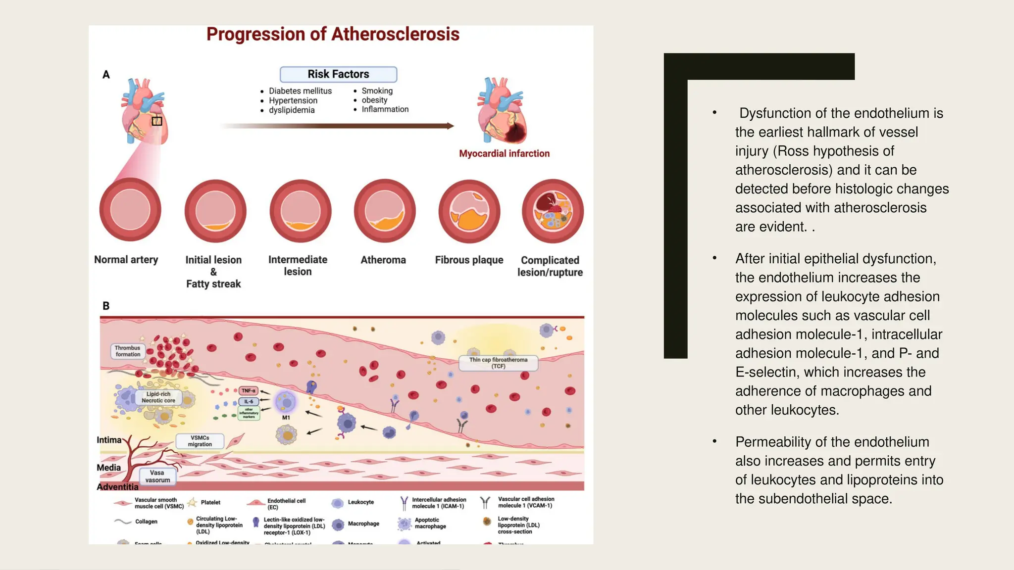 • Dysfunction of the endothelium is
the earliest hallmark of vessel
injury (Ross hypothesis of
atherosclerosis) and it can be
detected before histologic changes
associated with atherosclerosis
are evident. .
• After initial epithelial dysfunction,
the endothelium increases the
expression of leukocyte adhesion
molecules such as vascular cell
adhesion molecule-1, intracellular
adhesion molecule-1, and P- and
E-selectin, which increases the
adherence of macrophages and
other leukocytes.
• Permeability of the endothelium
also increases and permits entry
of leukocytes and lipoproteins into
the subendothelial space.
 
