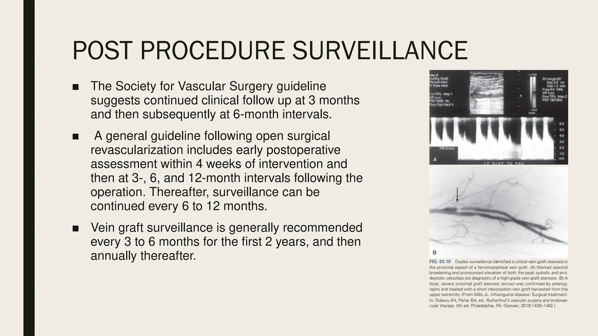 POST PROCEDURE SURVEILLANCE
■ The Society for Vascular Surgery guideline
suggests continued clinical follow up at 3 months
and then subsequently at 6-month intervals.
■ A general guideline following open surgical
revascularization includes early postoperative
assessment within 4 weeks of intervention and
then at 3-, 6, and 12-month intervals following the
operation. Thereafter, surveillance can be
continued every 6 to 12 months.
■ Vein graft surveillance is generally recommended
every 3 to 6 months for the first 2 years, and then
annually thereafter.
 