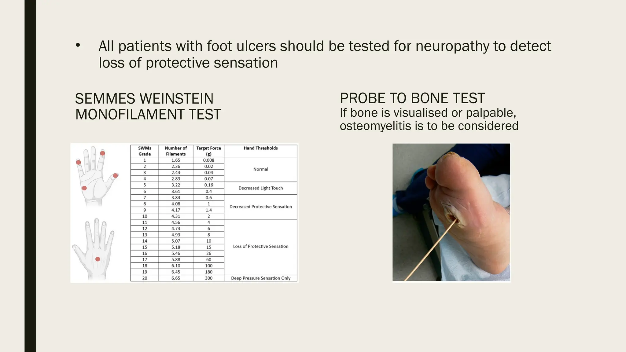• All patients with foot ulcers should be tested for neuropathy to detect
loss of protective sensation
PROBE TO BONE TEST
If bone is visualised or palpable,
osteomyelitis is to be considered
SEMMES WEINSTEIN
MONOFILAMENT TEST
 