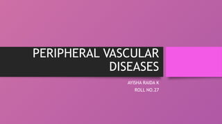 Peripheral vascular disease medicine powerpoint presentation | PPTX