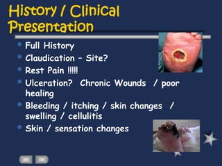 History / Clinical
Presentation
 Full History
 Claudication – Site?
 Rest Pain !!!!!
 Ulceration? Chronic Wounds / poor
healing
 Bleeding / itching / skin changes /
swelling / cellulitis
 Skin / sensation changes
 