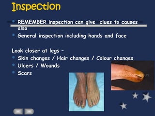 Inspection
 REMEMBER inspection can give clues to causes
also
 General inspection including hands and face
Look closer at legs –
 Skin changes / Hair changes / Colour changes
 Ulcers / Wounds
 Scars
 