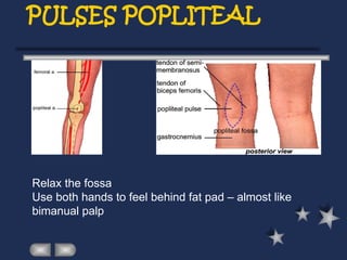PULSES POPLITEAL
Relax the fossa
Use both hands to feel behind fat pad – almost like
bimanual palp
 