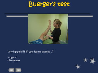 Buerger’s test
“Any hip pain if I lift your leg up straight…?”
Angles ?
<20 severe
 