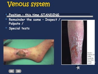 Venous system
 Position – this time STANDING
 Remainder the same – Inspect /
Palpate /
 Special tests
 