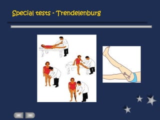 Special tests - Trendelenburg
 