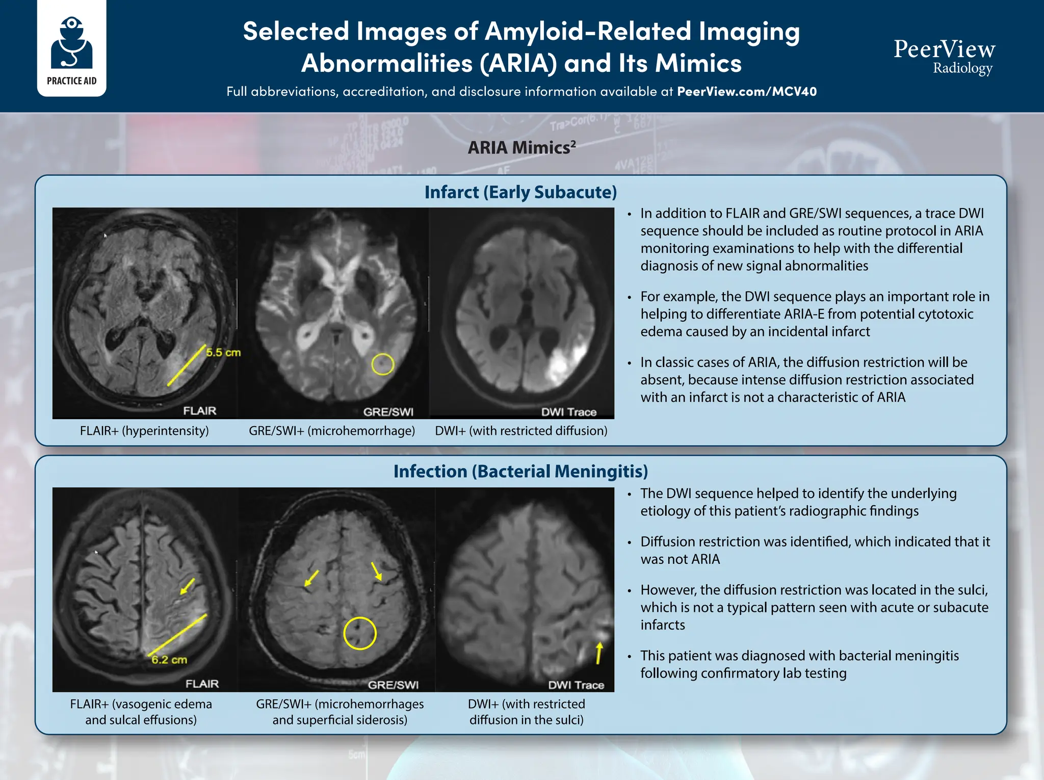 Improving The Recognition And Management Of Amyloid Related Imaging Improving The Recognition And Management Of Amyloid Related Imaging