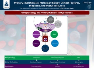 Pathophysiology and Primary Mutations in Myelofibrosis1
Pathophysiology Inflammation Inefficient hematopoiesis EMH
Clinical Manifestations Constitutional systems Cytopenia(s) and/or cytosis Splenomegaly
Complications Thromboembolism Infection Portal hypertension
!
Myeloproliferation
Neoangiogenesis
Stem Cell
Mobilization
Osteosclerosis
Fibrosis
Cytogenetic
Abnormalities
+8, -7/7q-, i(17q), -5/5q-,
12p-, inv(3),
11q23 rearrangement
!
!
! #)%"3'(.
CALR
CALR
Endoplasmic
reticulum
JAK2
515
exon 9
mutation
MPL
STAT
ON
exon 12
mutation
or
V617F
HSC
Other Genetic
Mutations
LNK, CBL, TET2, U2AF1,
ASXL1, IDH1, IDH2,
IKZF1, EZH2, DNMT3A,
TP53, SF3B1, SFSR2
Primary Myelofibrosis: Molecular Biology, Clinical Features,
Diagnosis, and Useful Resources
Full abbreviations, accreditation, and disclosure information available at PeerView.com/ZZW40
 