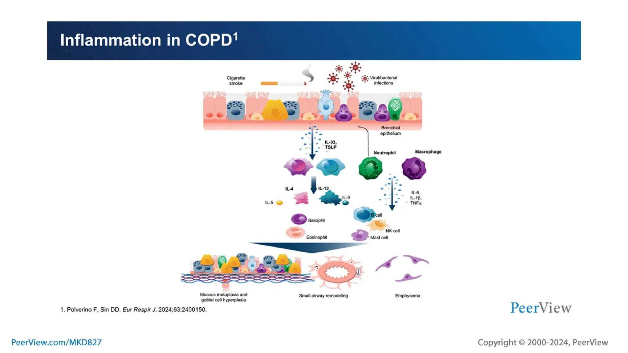 Targeting a New Approach in COPD: Understanding the Potential Role of ...
