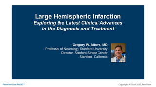 Large Hemispheric Infarction: Exploring the Latest Clinical Advances in the Diagnosis and Treatment