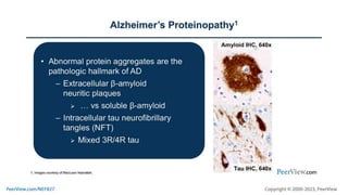 Navigating the New Era of Molecularly Defined Care in Alzheimer’s Disease: Applying Nuclear Medicine to Quantify Neuropathology and Improve Diagnostic Accuracy in the Earliest Stages of the AD Continuum