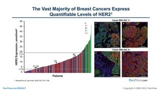 A New View of the Spectrum of HER2 Expression and Significance of HER2 Low in Breast Cancer: Exploring the Biology and Updating Best Practices for Testing and Treatment