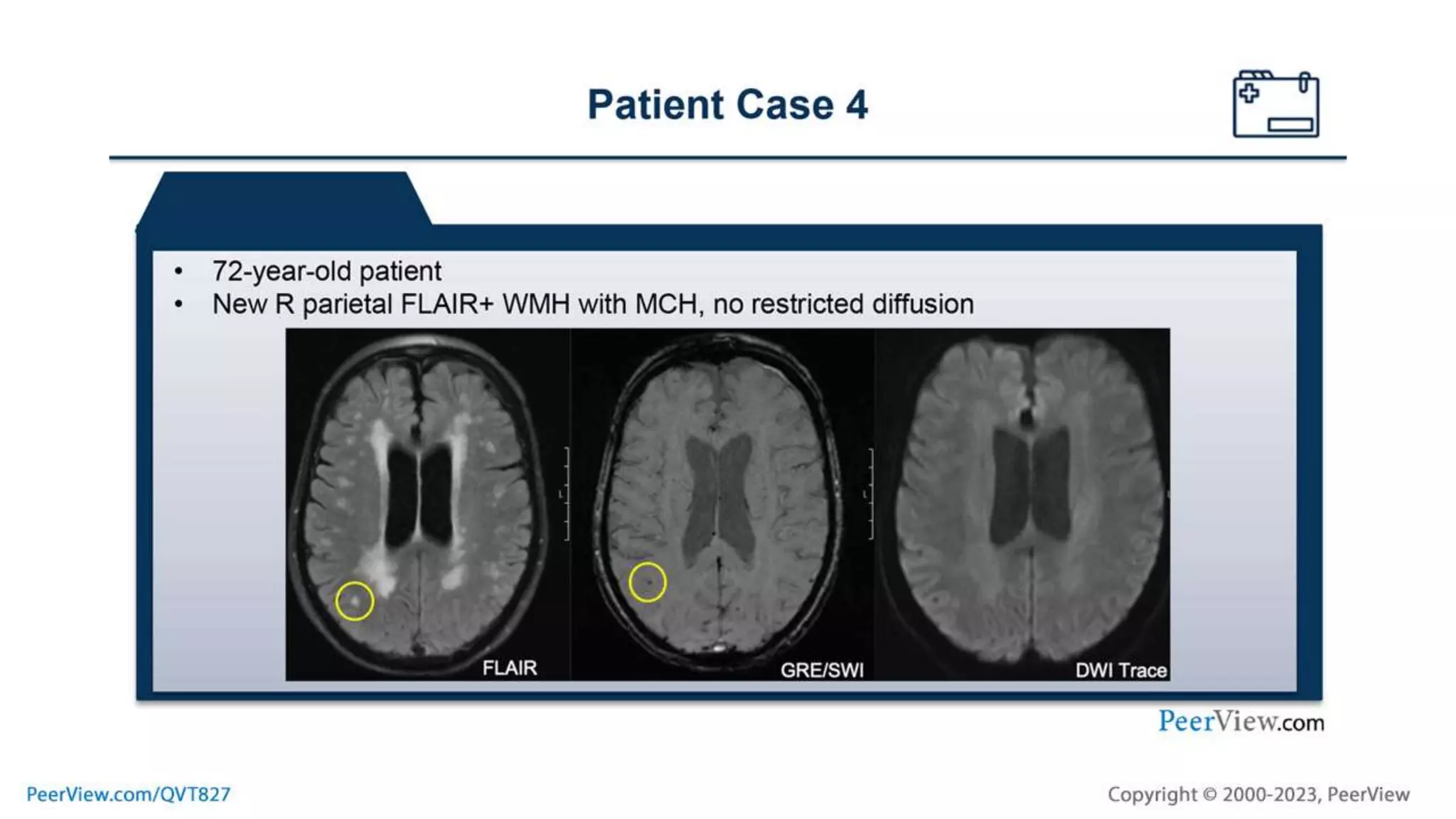 Case by Case: Actioning Patient-Centered Strategies for Risk Assessment ...
