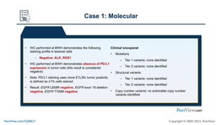 Neoadjuvant, Adjuvant, or Both: How to Solve the Puzzle of Perioperative Immunotherapy, Individualize Treatment Plans, and Improve Cure Rates in Resectable NSCLC