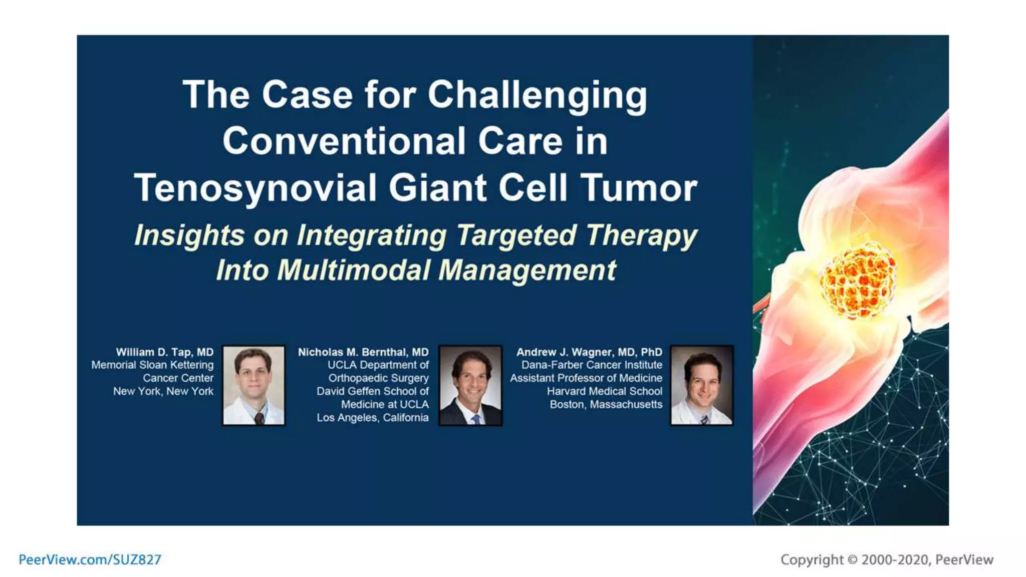 The Case for Challenging Conventional Care in Tenosynovial Giant Cell ...