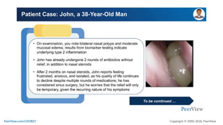 Treating With Precision in CRSwNP: Defining the Role of Targeted ...