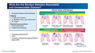 Resectable Organization The Immunotherapy Playbook for Resectable NSCLC: Real-World Challenges ...