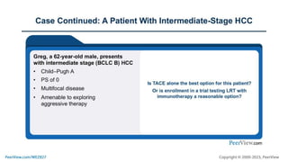 Essential Conversations for HCC: Radiology-Oncology Collaboration and Immunotherapy Advances in Intermediate and Advanced Disease