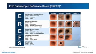 Smoothing the Way in Eosinophilic Esophagitis: Targeted, Team-Based ...