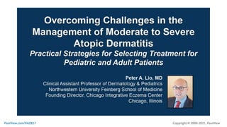 Overcoming Challenges in the Management of Moderate to Severe Atopic Dermatitis: Practical Strategies for Selecting Treatment for Pediatric and Adult Patients